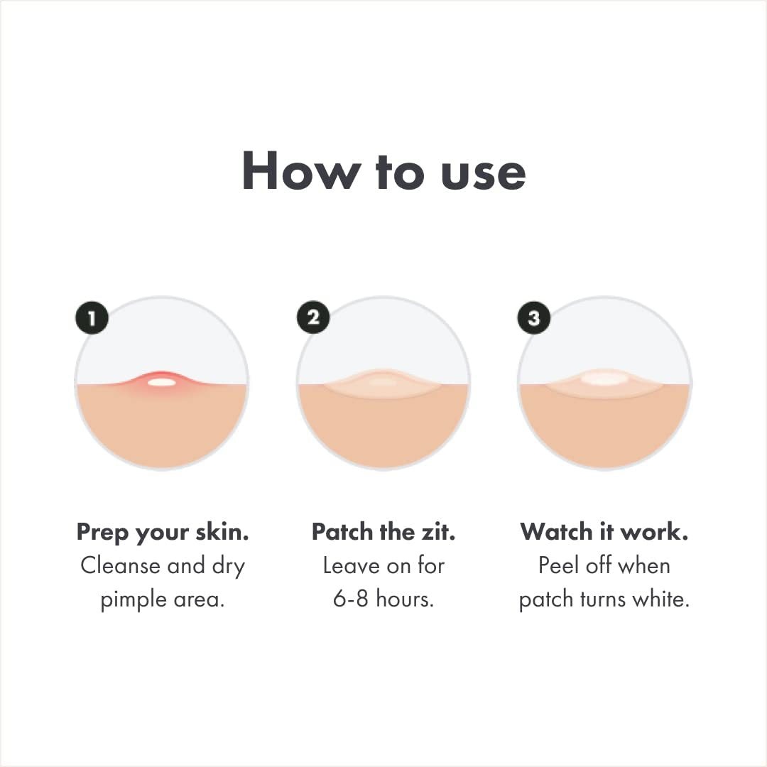 ACNE PATCHES